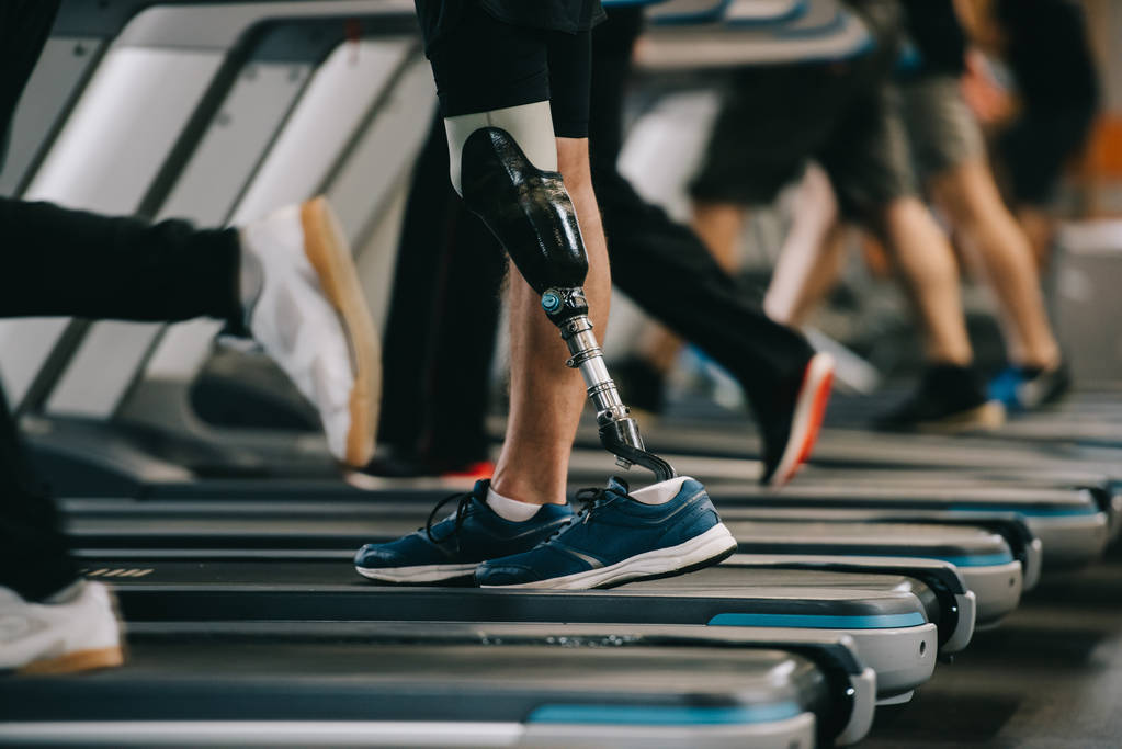 A below knee amputee walking on a treadmill.